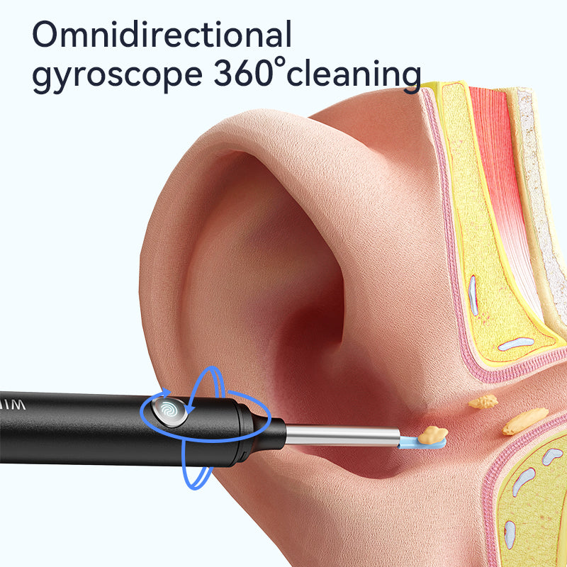 Pro-Grade Ear Cleaner with 1080P Camera ✨ Real-Time Ear Wax Removal for iPhone/Android 💡 Surgery-Level Visibility + Kid-Safe Scoop 🌟 #EarHack #OddlySatisfying